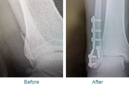 before and after treatment